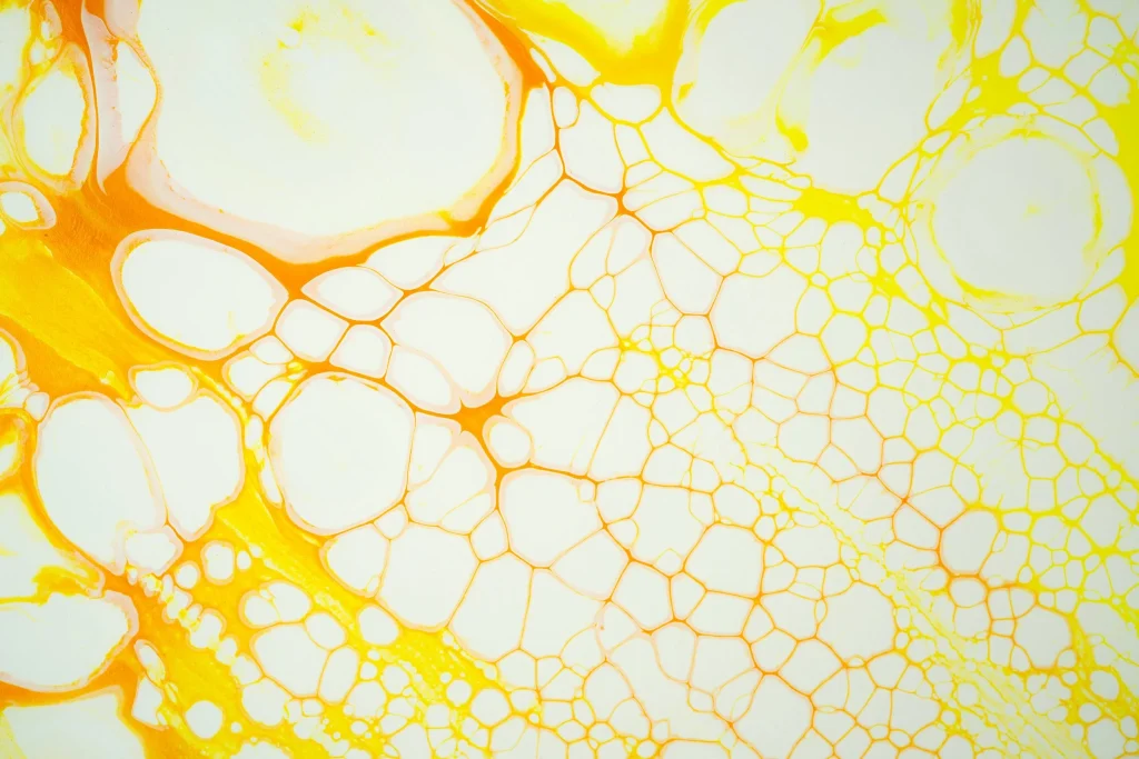 Fat grafting - how your own fat can restore shape