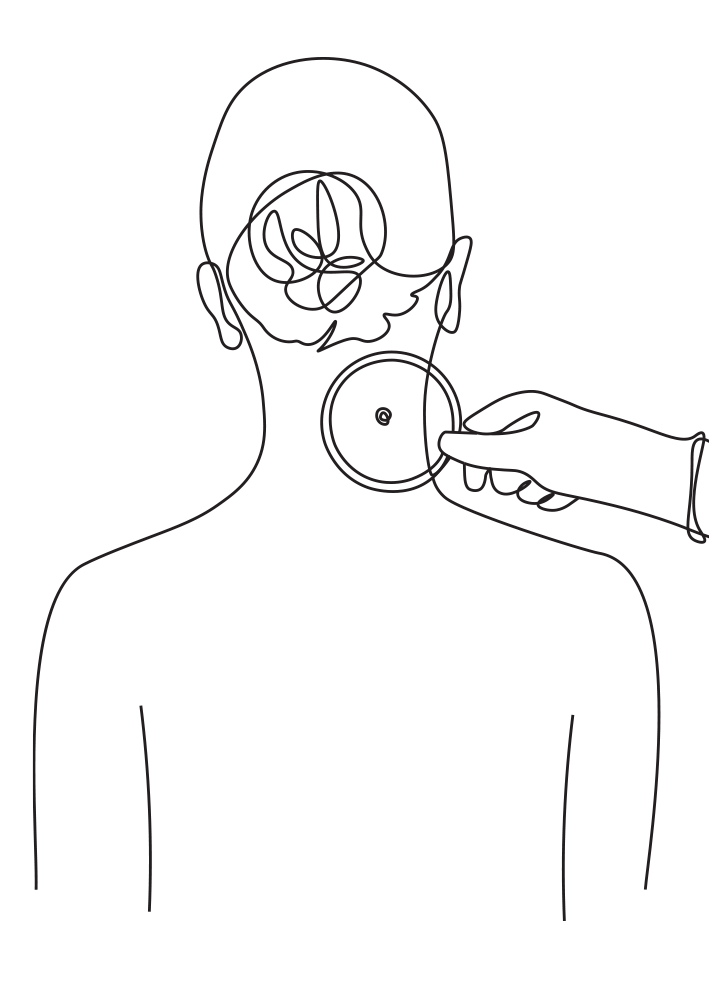Skin cancer surgery - Dr Jenaleen Law, plastic surgeon Sydney