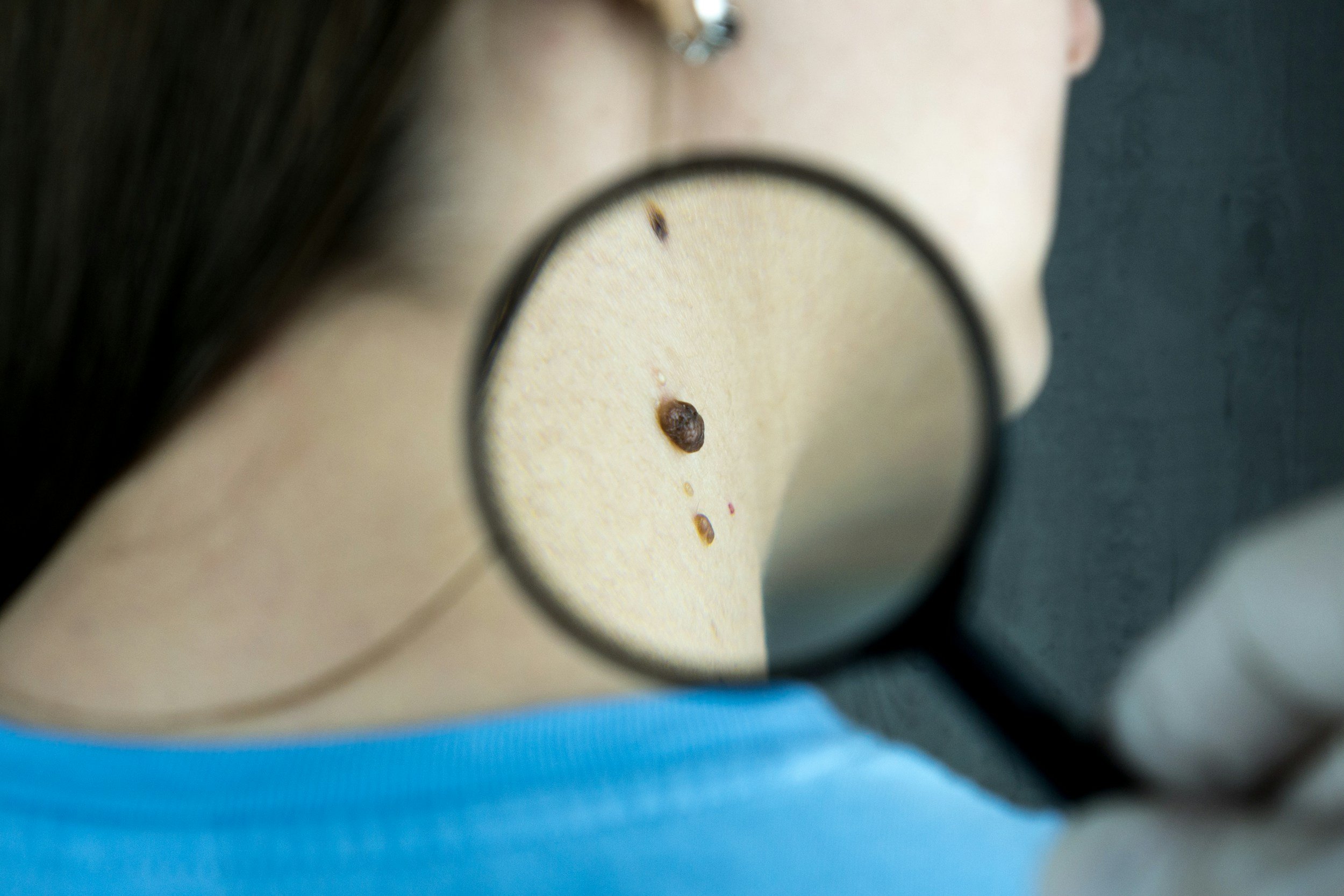 Dr Law Skin Cancer Surgery Sydney Darlinghurst Chatswood Eastern Suburbs North Shore
