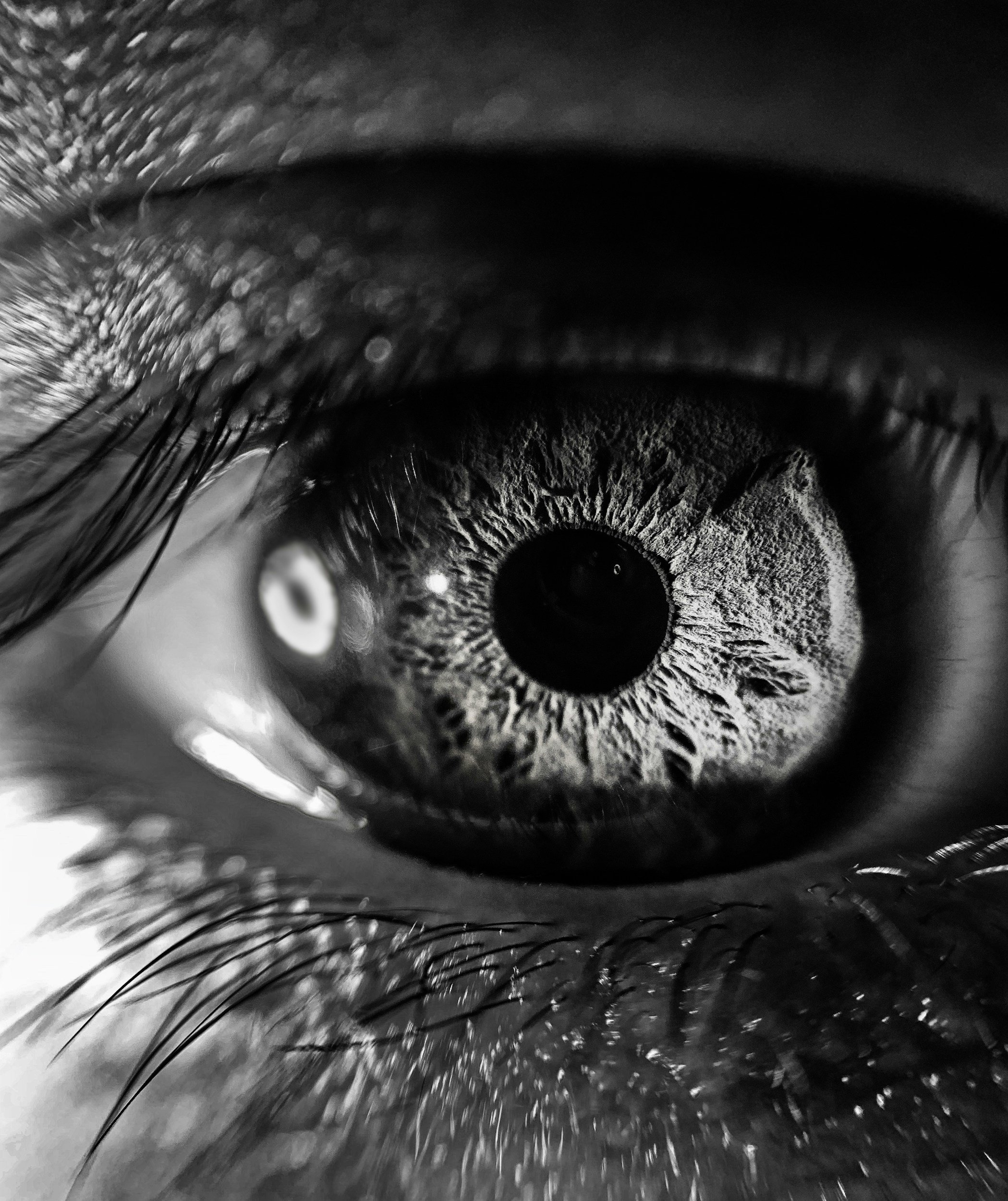 Upper Blepharoplasty Dr Jen Law Sydney